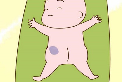 胎记会不会影响到孩子的正常发育？