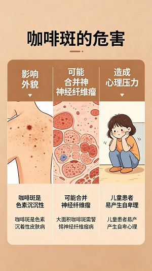咖啡斑需要治疗吗？南京胎记研究院